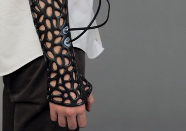 3D Printed Cast With Ultrasonic Vibrations Helps Speed Up Recovery