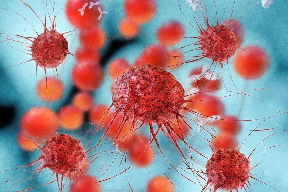 a-new-high-risk-subtype-of-cancer-has-been-discovered