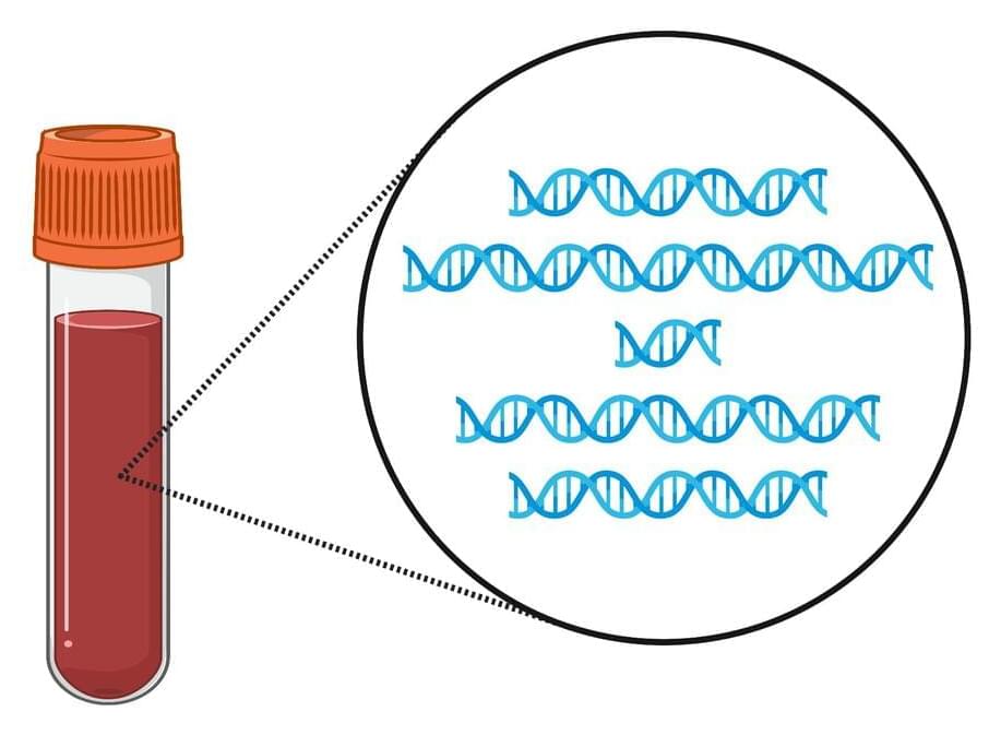 Blood Test Uses Fragmentomics To Detect Liver Cancer