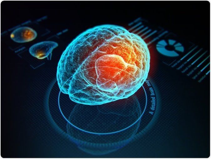 Neural interfaces, brain-computer interfaces and other devices that blur the lines between mind and machine have extraordinary potential. Image Credit: Iaremenko Sergii / Shutterstock