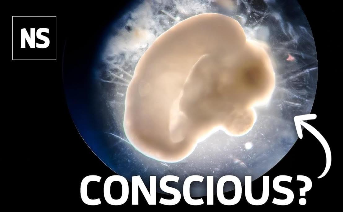 Brain Organoids Are Unlocking the Secrets of the Human Mind – Lifeboat ...