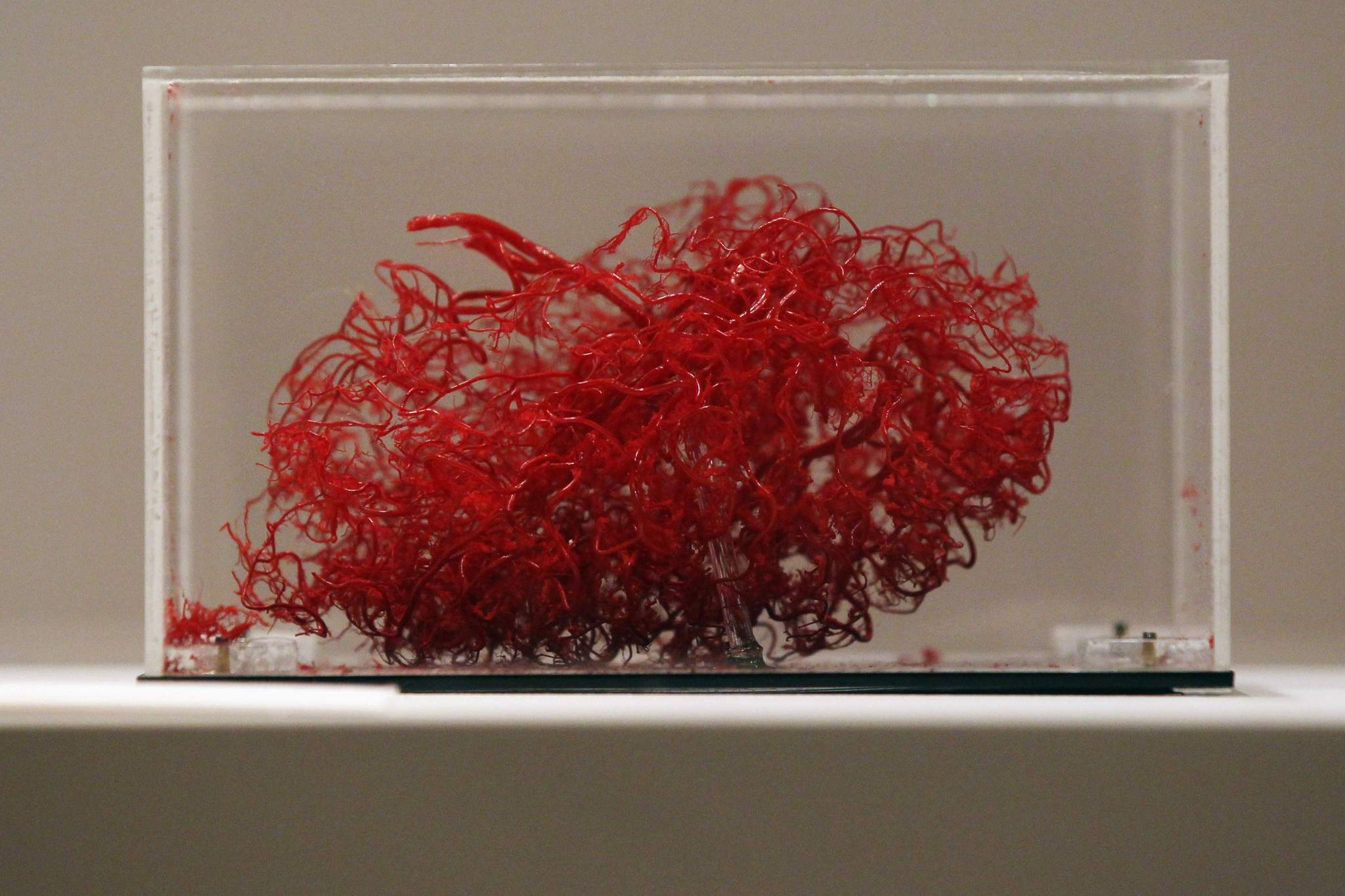 Californian Researchers 3d Print Functioning Blood Vessels