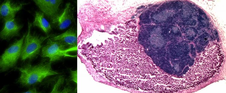 Fibroblasts transformed into induced thymic epithelial cells (iTEC)  in vitro (left, iTEC in green).  iTEC transplanted onto the mouse kidney form an organised and functional mini-thymus (right, kidney cells in pink, thymus cells in dark blue).