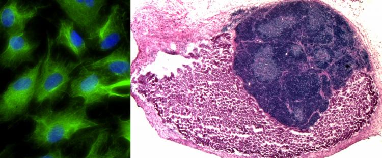 Fibroblasts transformed into induced thymic epithelial cells (iTEC) in vitro (left, iTEC in green).  iTEC transplanted onto the mouse kidney form an organised and functional mini-thymus (right, kidney cells in pink, thymus cells in dark blue).