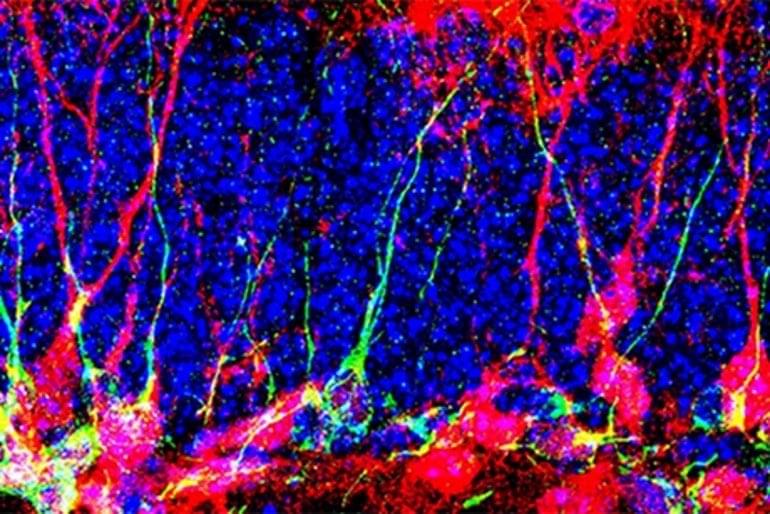 How To Generate New Neurons In The Brain