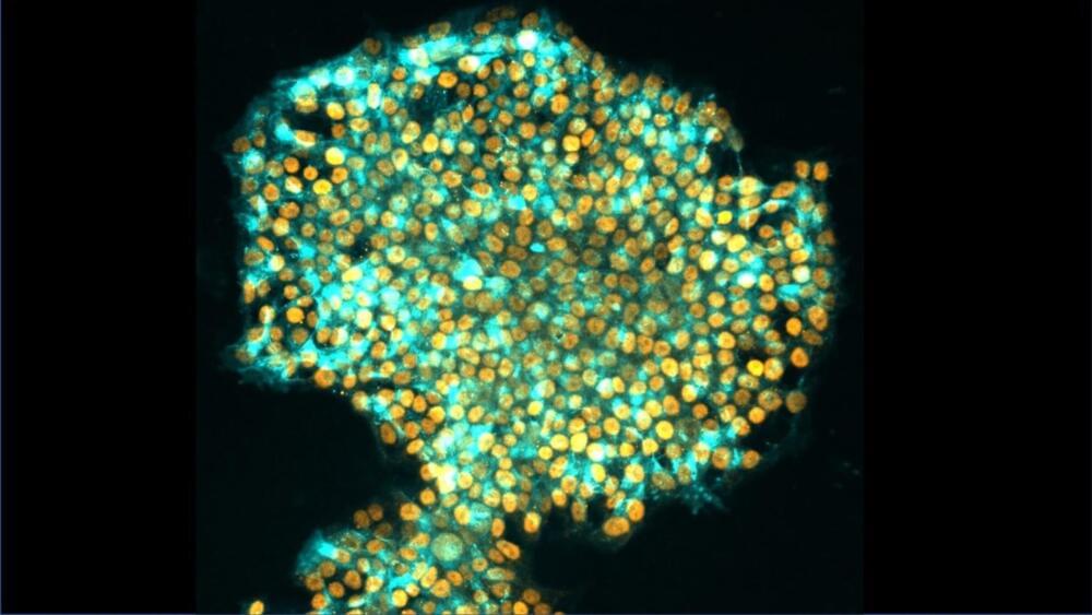 How To Insert Cells In A Cell