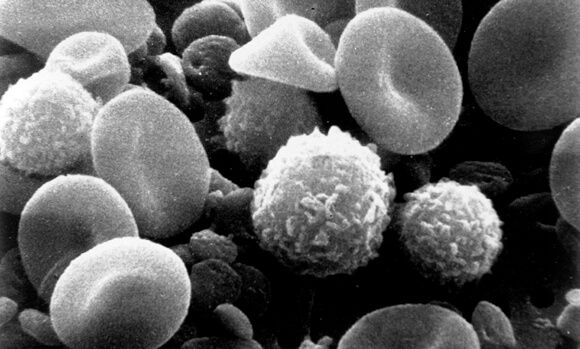 white-blood-cells-cancer-blood-test 1