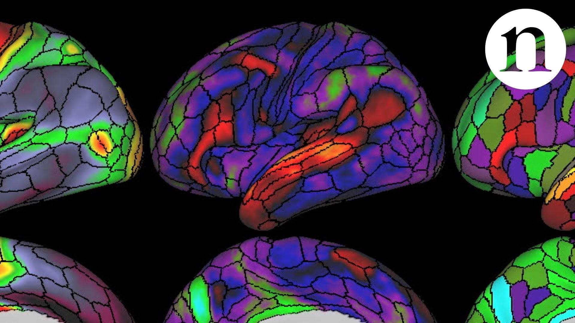 Brain карта. Топографическое картирование электрической активности мозга. Картирование мозга коры. Компьютерное моделирование мозга. Функциональное картирование головного мозга.