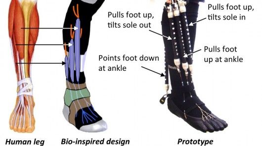 A diagram of the experimental orthotic device 