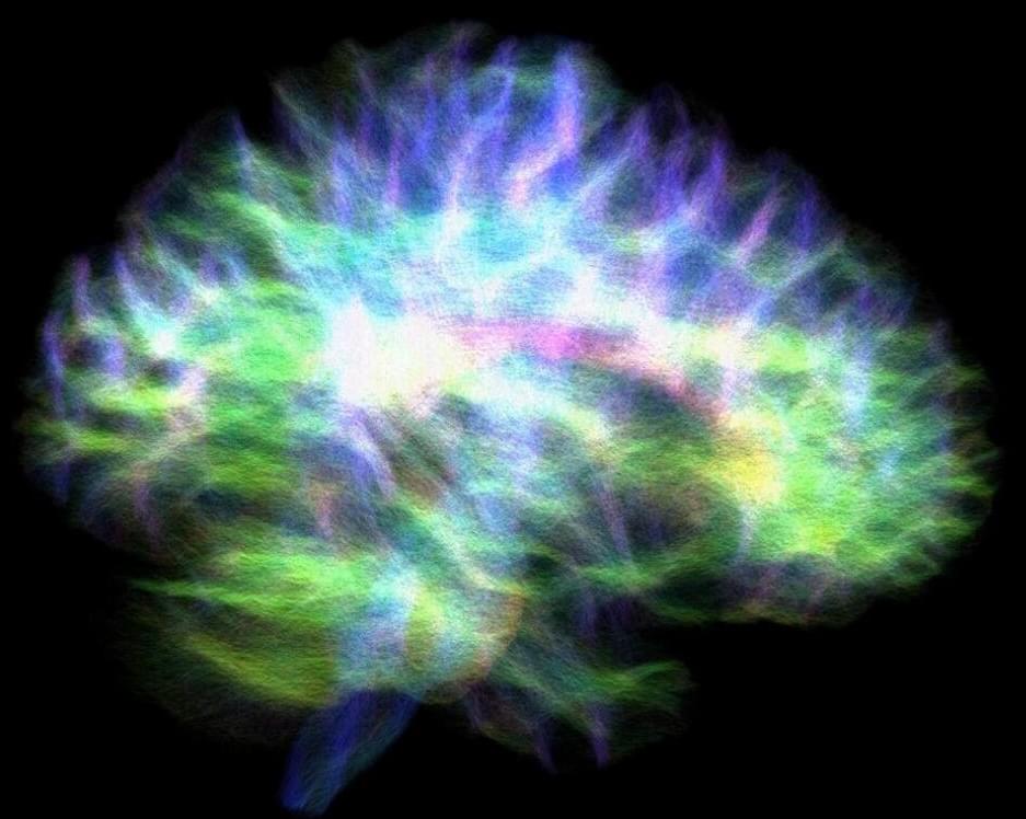 The most detailed map ever made of the brain’s memory center has been ...