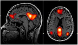 fmri5